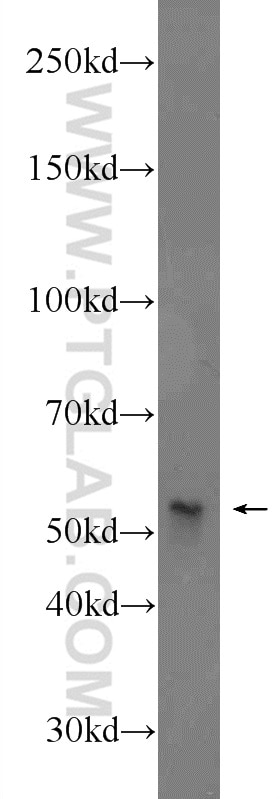 Western Blot (WB) analysis of rat liver tissue using B7‑H4 Polyclonal antibody (12080-1-AP)