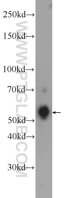 Western Blot (WB) analysis of HeLa cells using B7‑H4 Polyclonal antibody (12080-1-AP)