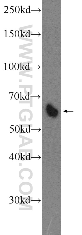 Western Blot (WB) analysis of mouse liver tissue using B7‑H4 Polyclonal antibody (12080-1-AP)