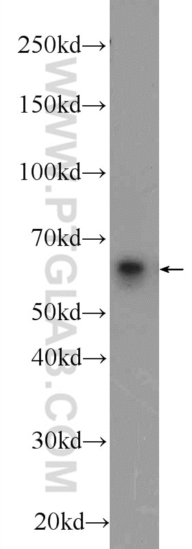 Western Blot (WB) analysis of A549 cells using B7‑H4 Polyclonal antibody (12080-1-AP)
