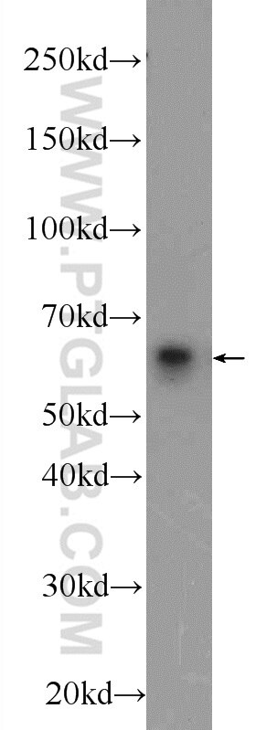 WB analysis of A549 using 12080-1-AP