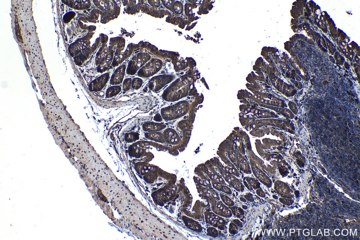 Immunohistochemistry (IHC) staining of mouse colon tissue using B7‑H4 Monoclonal antibody (66817-1-Ig)
