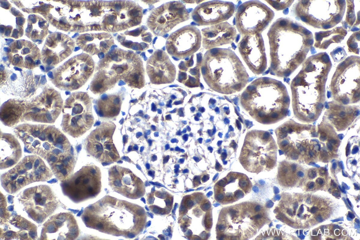 Immunohistochemistry (IHC) staining of rat kidney tissue using B7‑H4 Monoclonal antibody (66817-1-Ig)