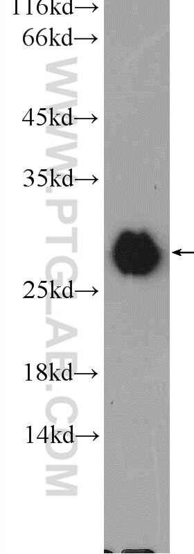 Western Blot (WB) analysis of mouse brain tissue using VTI1A Polyclonal antibody (12354-1-AP)
