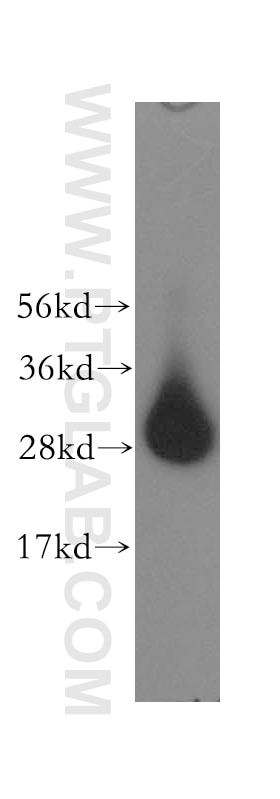 Western Blot (WB) analysis of human lung tissue using VTI1A Polyclonal antibody (12354-1-AP)