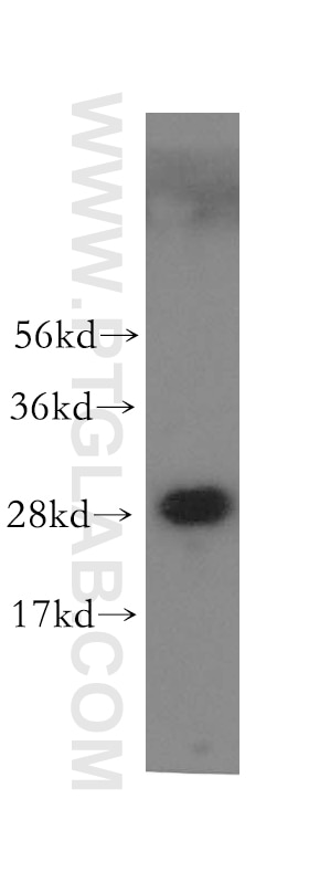 Western Blot (WB) analysis of human brain tissue using VTI1A Polyclonal antibody (12354-1-AP)