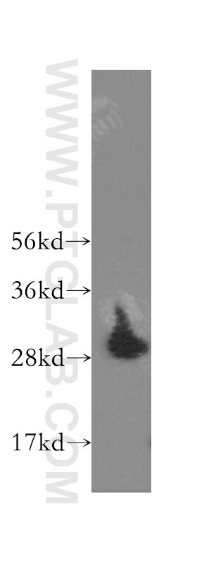 Western Blot (WB) analysis of human heart tissue using VTI1A Polyclonal antibody (12354-1-AP)