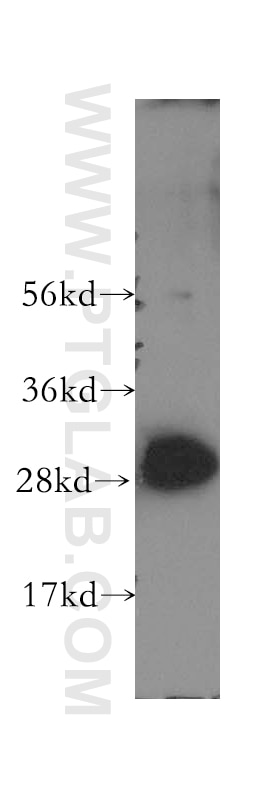 Western Blot (WB) analysis of human kidney tissue using VTI1A Polyclonal antibody (12354-1-AP)