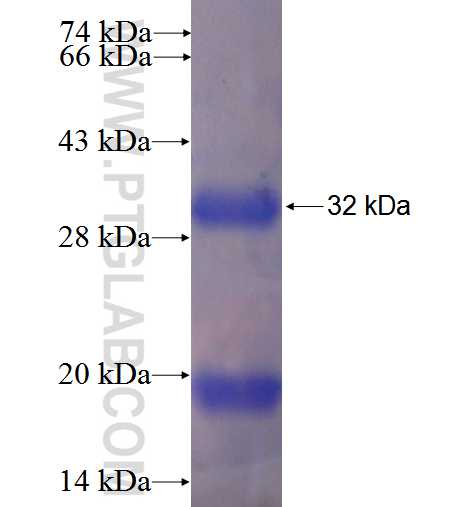 VTI1B fusion protein Ag5906 SDS-PAGE