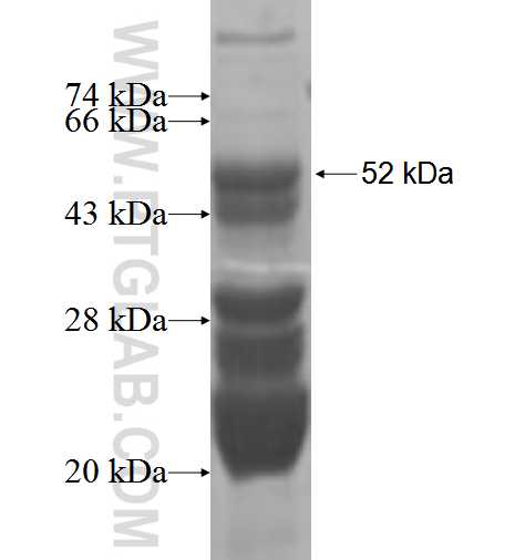 VTI1B fusion protein Ag5927 SDS-PAGE
