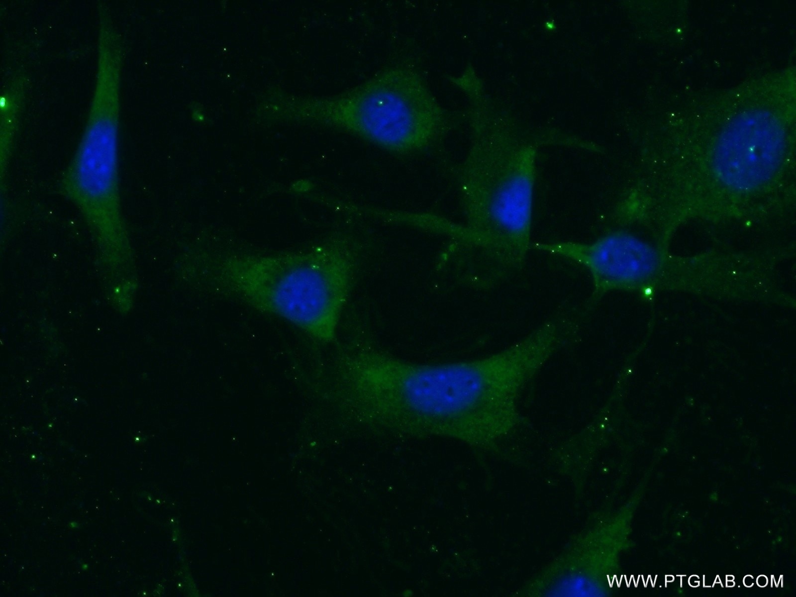 Immunofluorescence (IF) / fluorescent staining of NIH/3T3 cells using Vitronectin Polyclonal antibody (15833-1-AP)