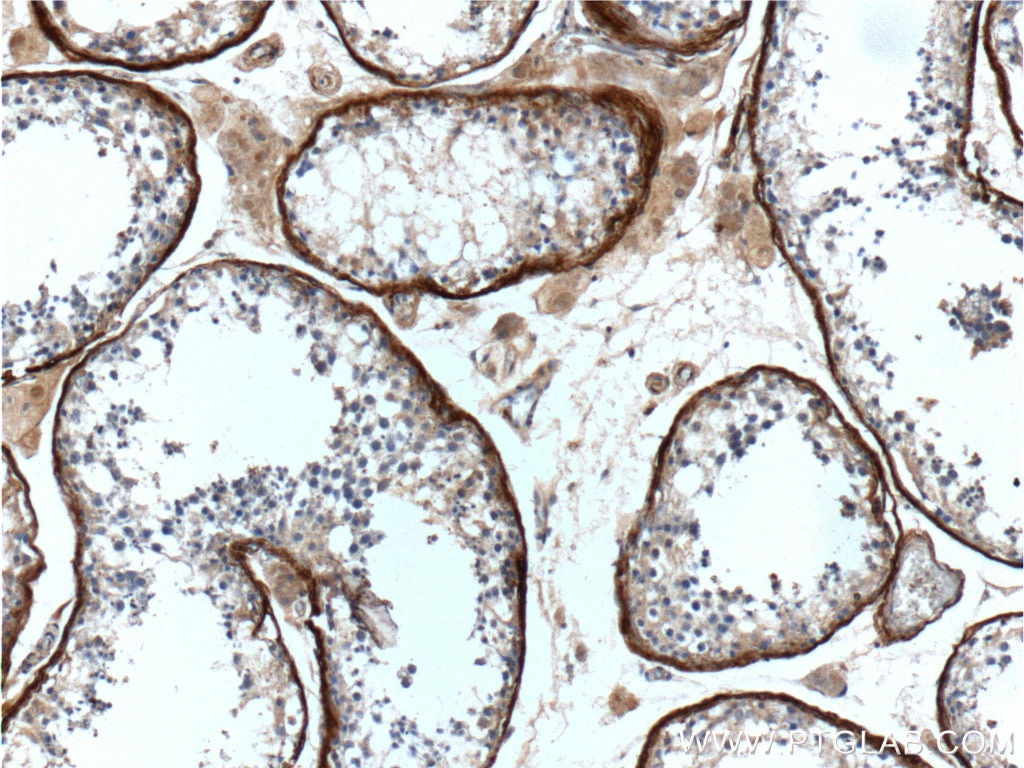 IHC staining of human testis using 15833-1-AP