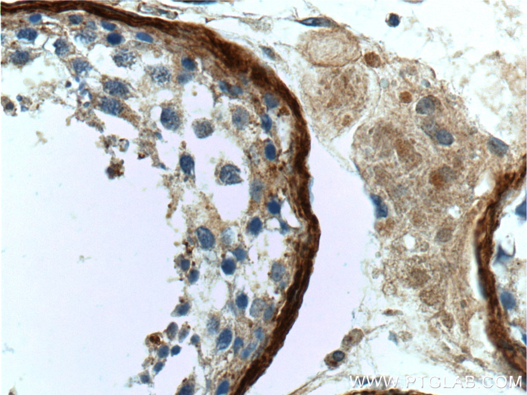 Immunohistochemistry (IHC) staining of human testis tissue using Vitronectin Polyclonal antibody (15833-1-AP)