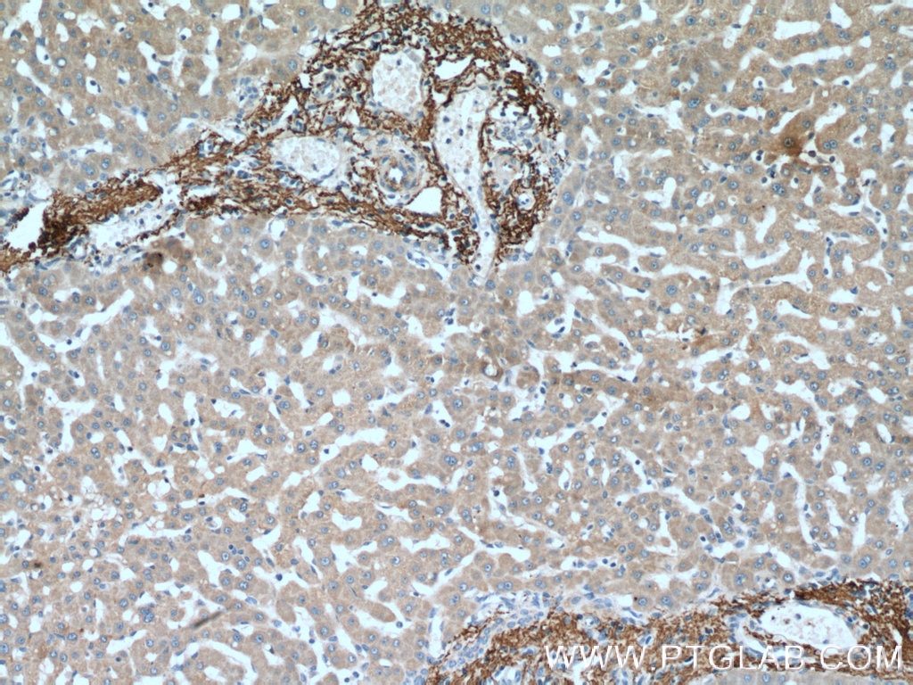 IHC staining of human liver using 15833-1-AP
