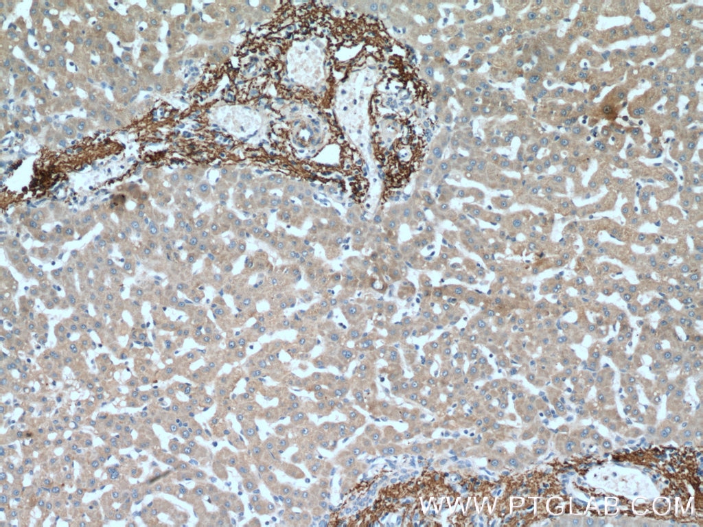 Immunohistochemistry (IHC) staining of human liver tissue using Vitronectin Polyclonal antibody (15833-1-AP)