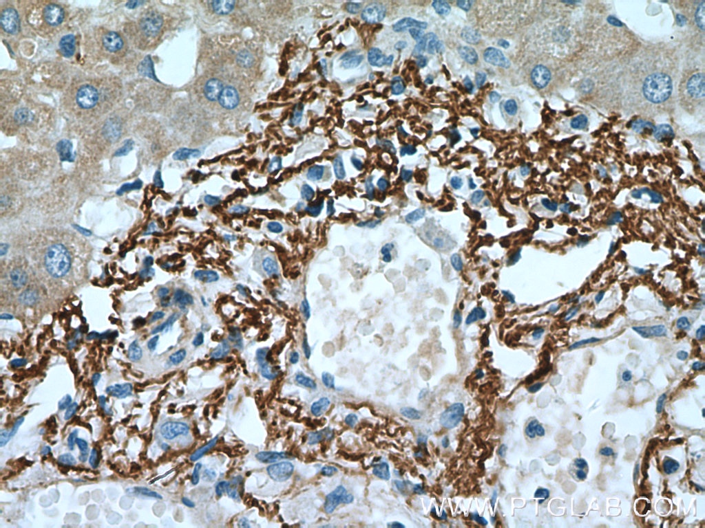 Immunohistochemistry (IHC) staining of human liver tissue using Vitronectin Polyclonal antibody (15833-1-AP)