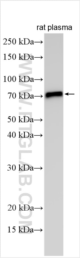 Western Blot (WB) analysis of various lysates using Vitronectin Polyclonal antibody (15833-1-AP)