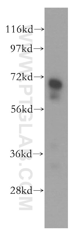 Western Blot (WB) analysis of human testis tissue using Vitronectin Polyclonal antibody (15833-1-AP)