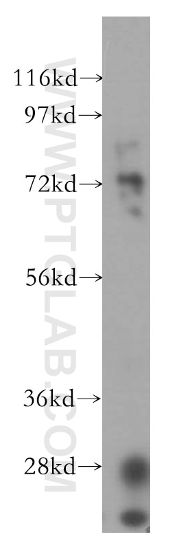 Western Blot (WB) analysis of NIH/3T3 cells using Vitronectin Polyclonal antibody (15833-1-AP)