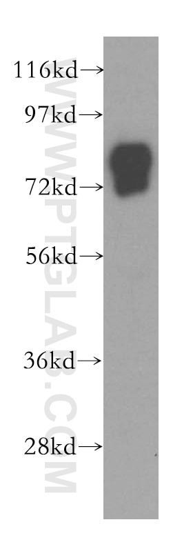 Western Blot (WB) analysis of human plasma using Vitronectin Polyclonal antibody (15833-1-AP)
