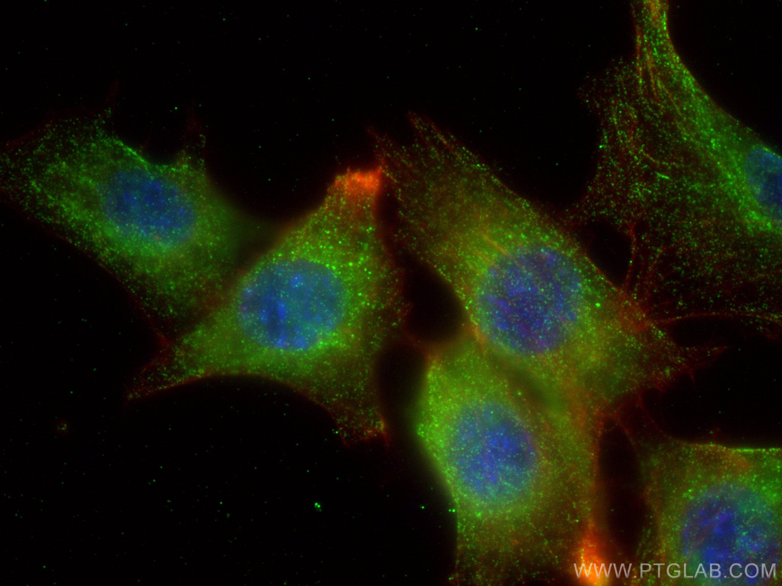 Immunofluorescence (IF) / fluorescent staining of NIH/3T3 cells using VTN Monoclonal antibody (66398-1-Ig)