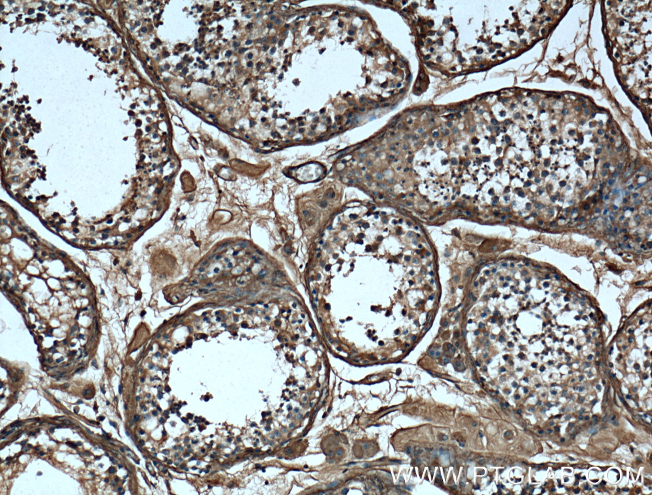 Immunohistochemistry (IHC) staining of human testis tissue using VTN Monoclonal antibody (66398-1-Ig)