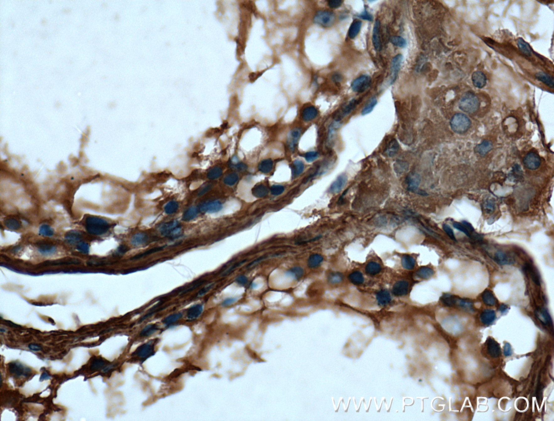 Immunohistochemistry (IHC) staining of human testis tissue using VTN Monoclonal antibody (66398-1-Ig)