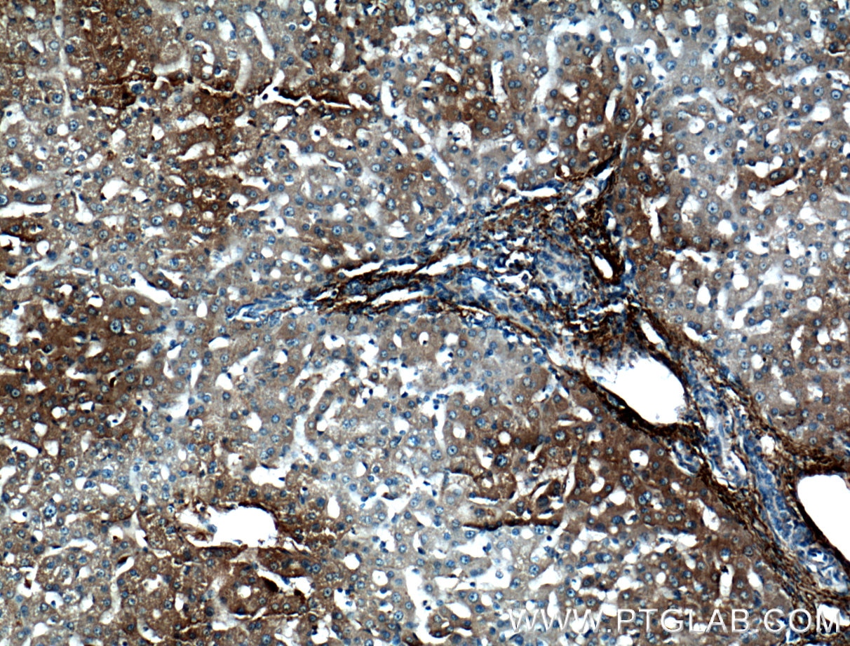 Immunohistochemistry (IHC) staining of human liver tissue using VTN Monoclonal antibody (66398-1-Ig)