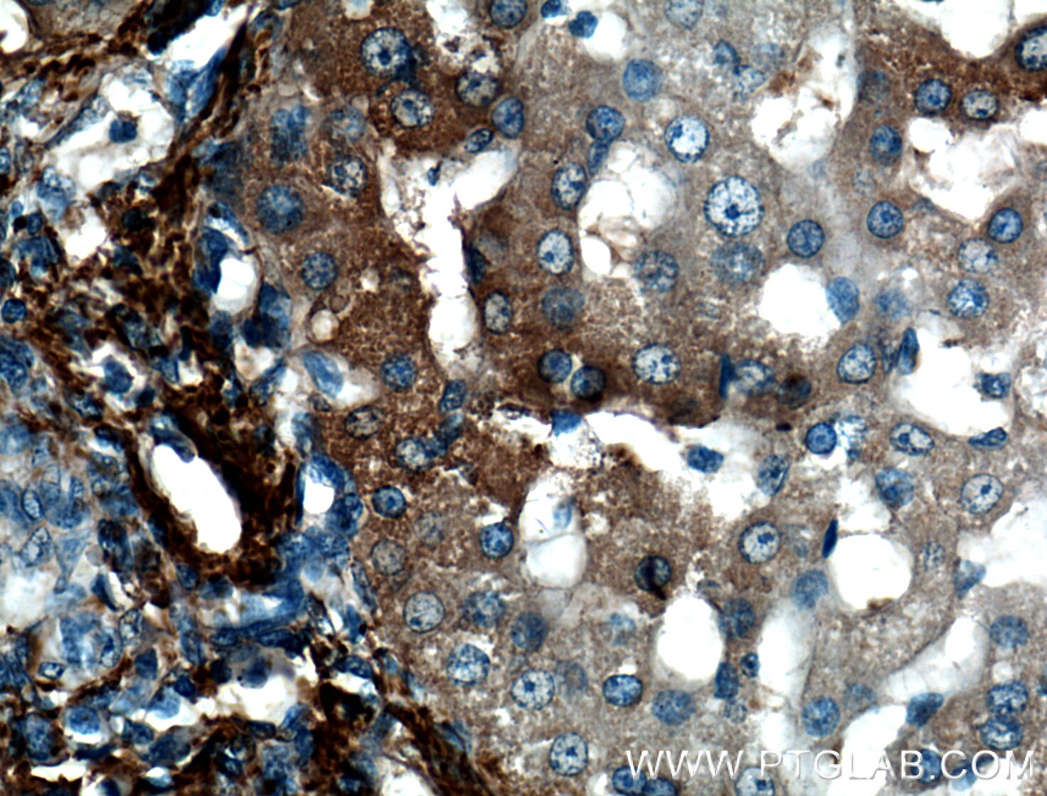 Immunohistochemistry (IHC) staining of human liver tissue using VTN Monoclonal antibody (66398-1-Ig)