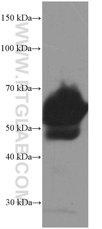 Western Blot (WB) analysis of human plasma using VTN Monoclonal antibody (66398-1-Ig)