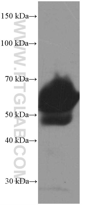 WB analysis of human plasma using 66398-1-Ig