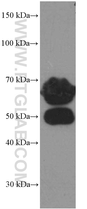 Western Blot (WB) analysis of rabbit serum using VTN Monoclonal antibody (66398-1-Ig)