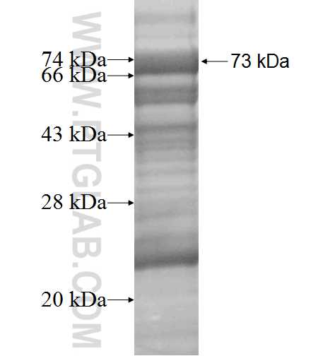 VWA1 fusion protein Ag5565 SDS-PAGE