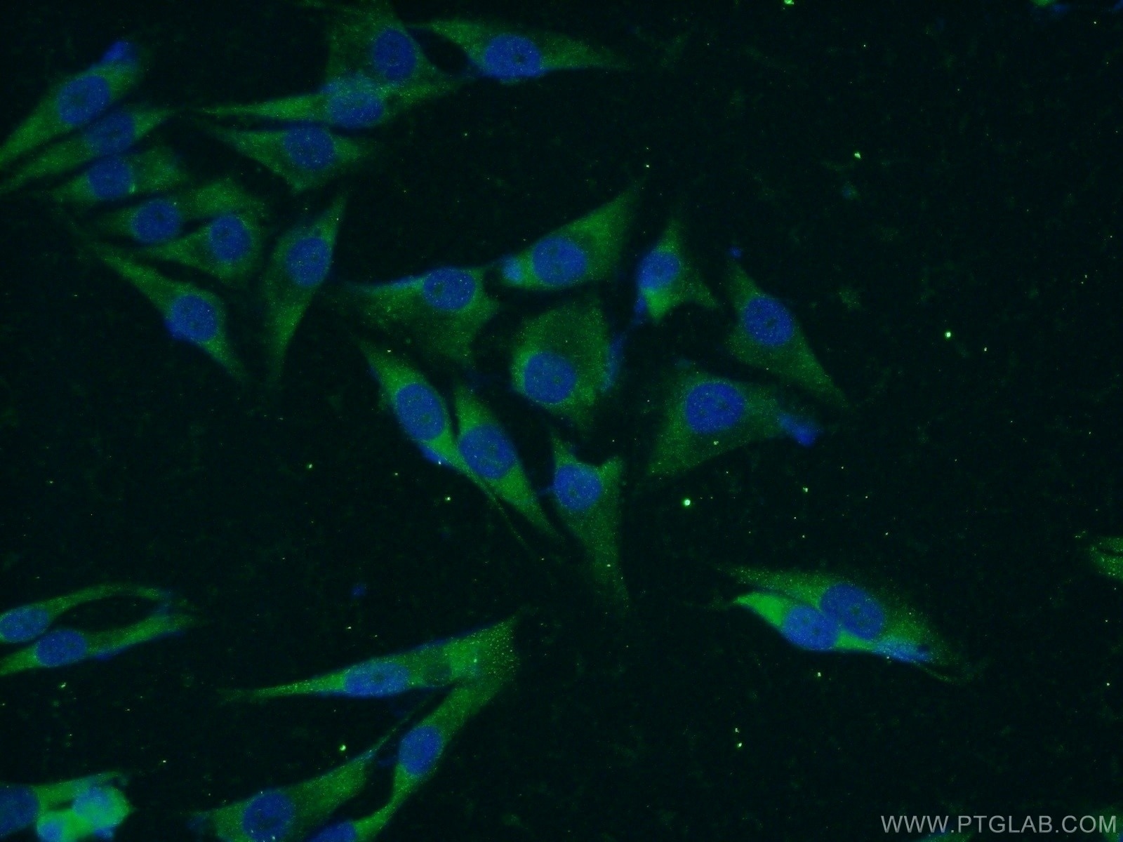 Immunofluorescence (IF) / fluorescent staining of A375 cells using VWA2 Polyclonal antibody (18714-1-AP)