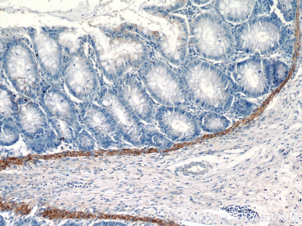 Immunohistochemistry (IHC) staining of human colon tissue using VWA2 Polyclonal antibody (18714-1-AP)