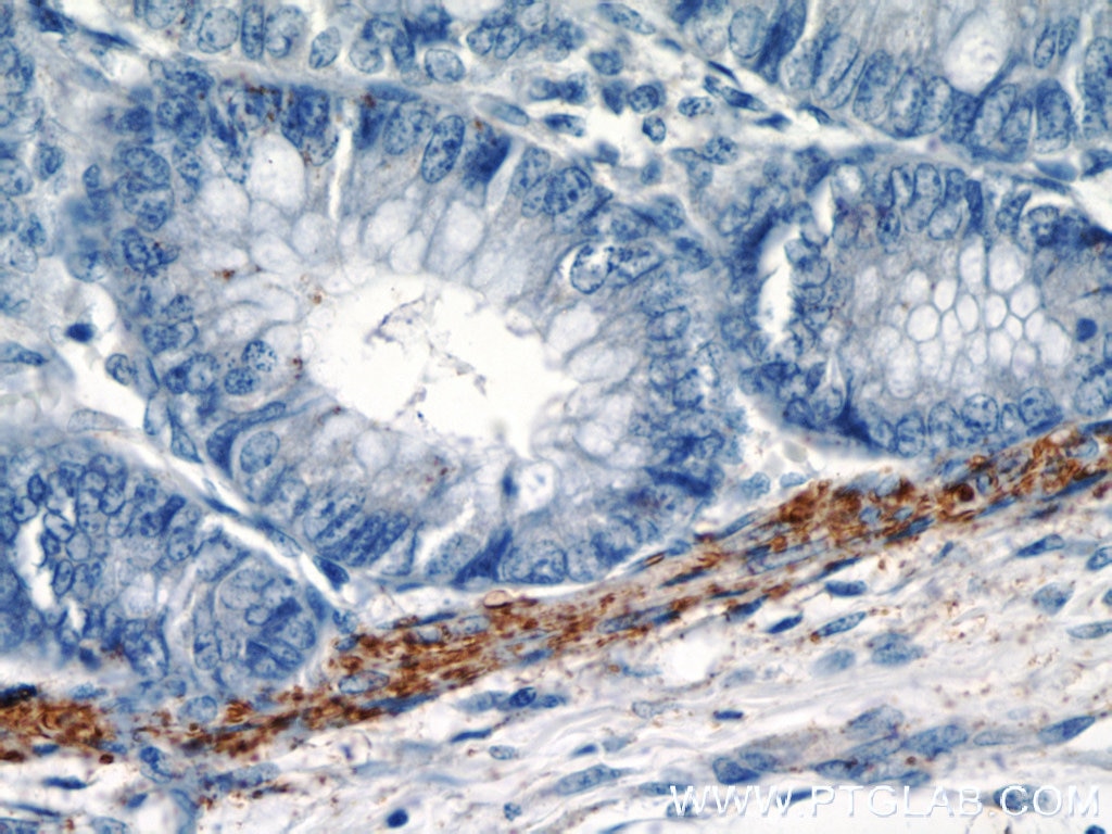 Immunohistochemistry (IHC) staining of human colon tissue using VWA2 Polyclonal antibody (18714-1-AP)