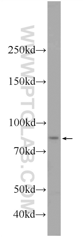 Western Blot (WB) analysis of A375 cells using VWA2 Polyclonal antibody (18714-1-AP)
