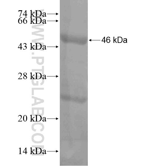 VWA2 fusion protein Ag18883 SDS-PAGE