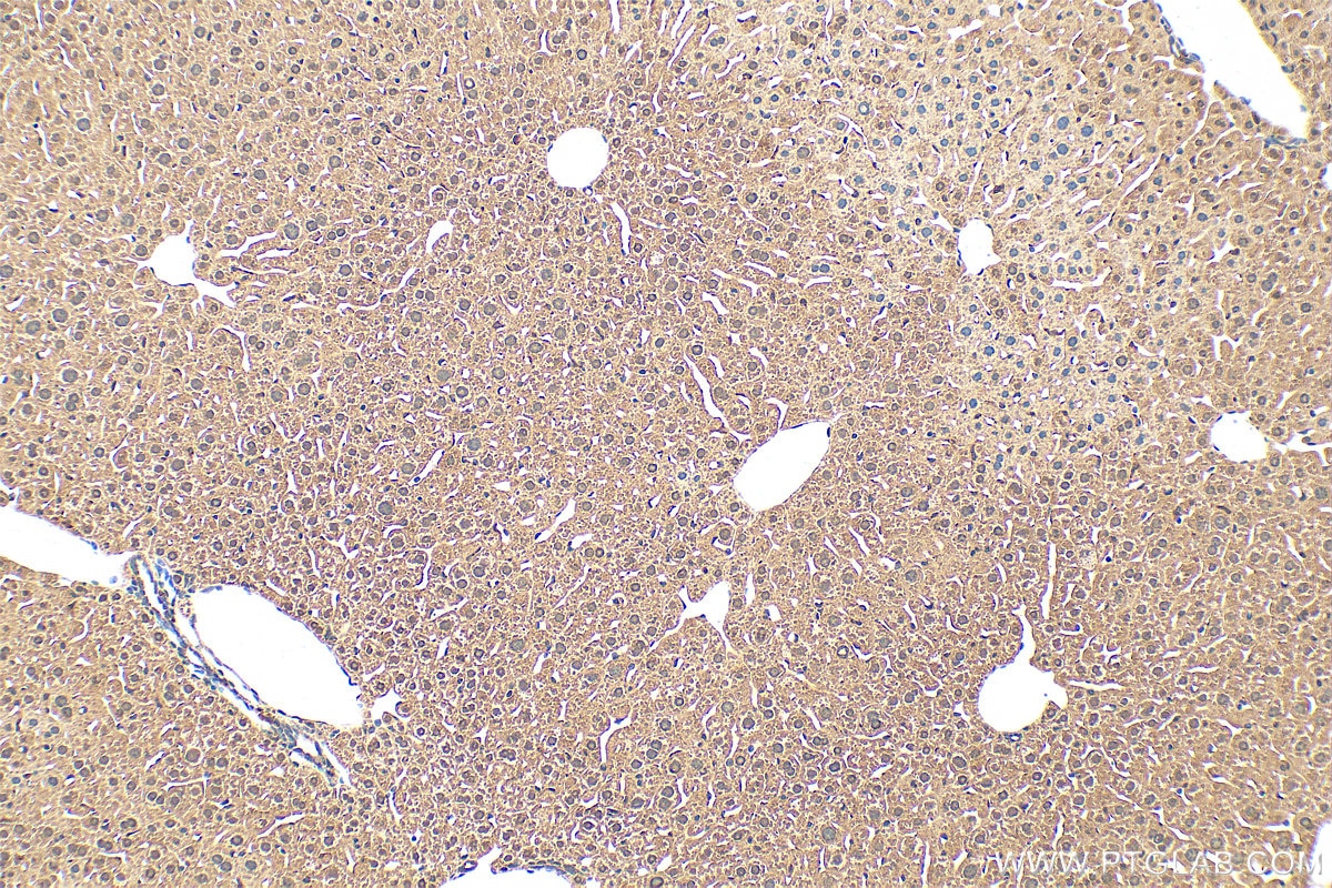 Immunohistochemistry (IHC) staining of mouse liver tissue using VWA5A Polyclonal antibody (26175-1-AP)
