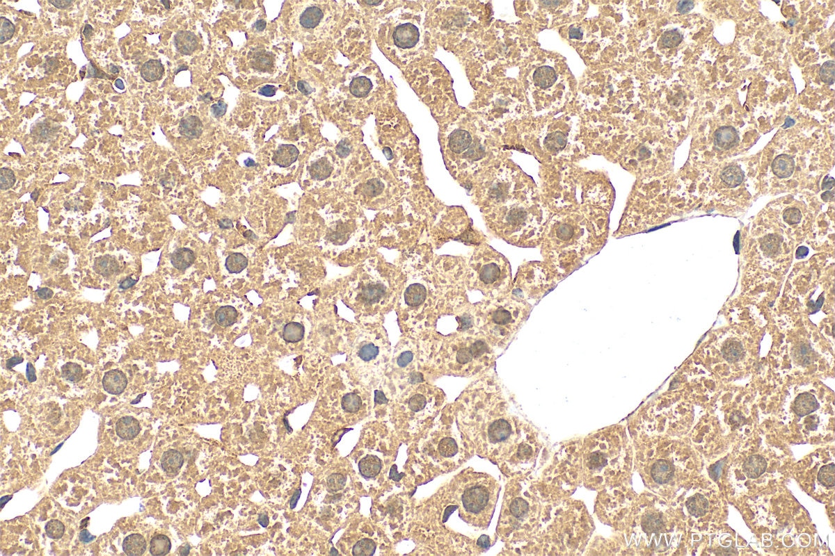 Immunohistochemistry (IHC) staining of mouse liver tissue using VWA5A Polyclonal antibody (26175-1-AP)