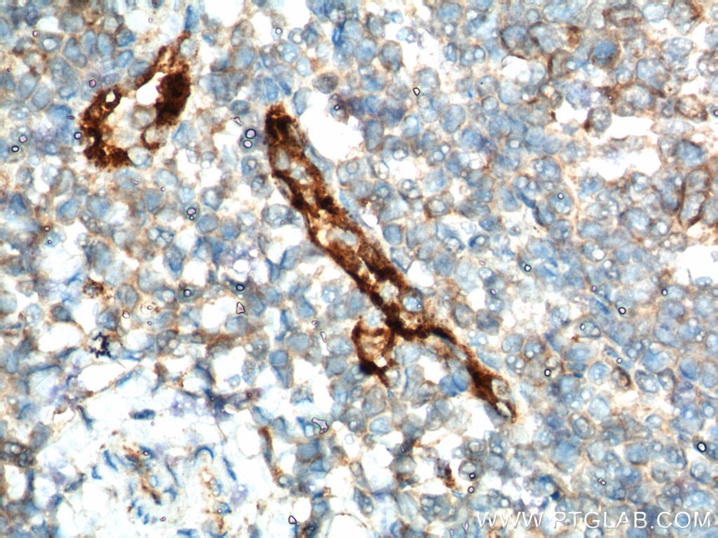 VWF, VWFpp Polyclonal antibody