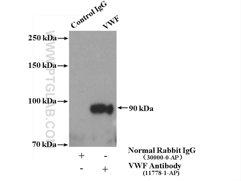 IP experiment of mouse spleen using 11778-1-AP