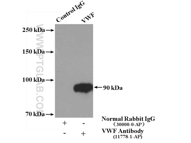 Immunoprecipitation (IP) experiment of mouse spleen tissue using VWF, VWFpp Polyclonal antibody (11778-1-AP)