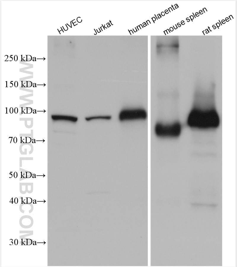 Western Blot (WB) analysis of various lysates using VWF, VWFpp Polyclonal antibody (11778-1-AP)