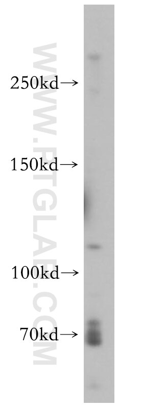 VWF, VWFpp Polyclonal antibody