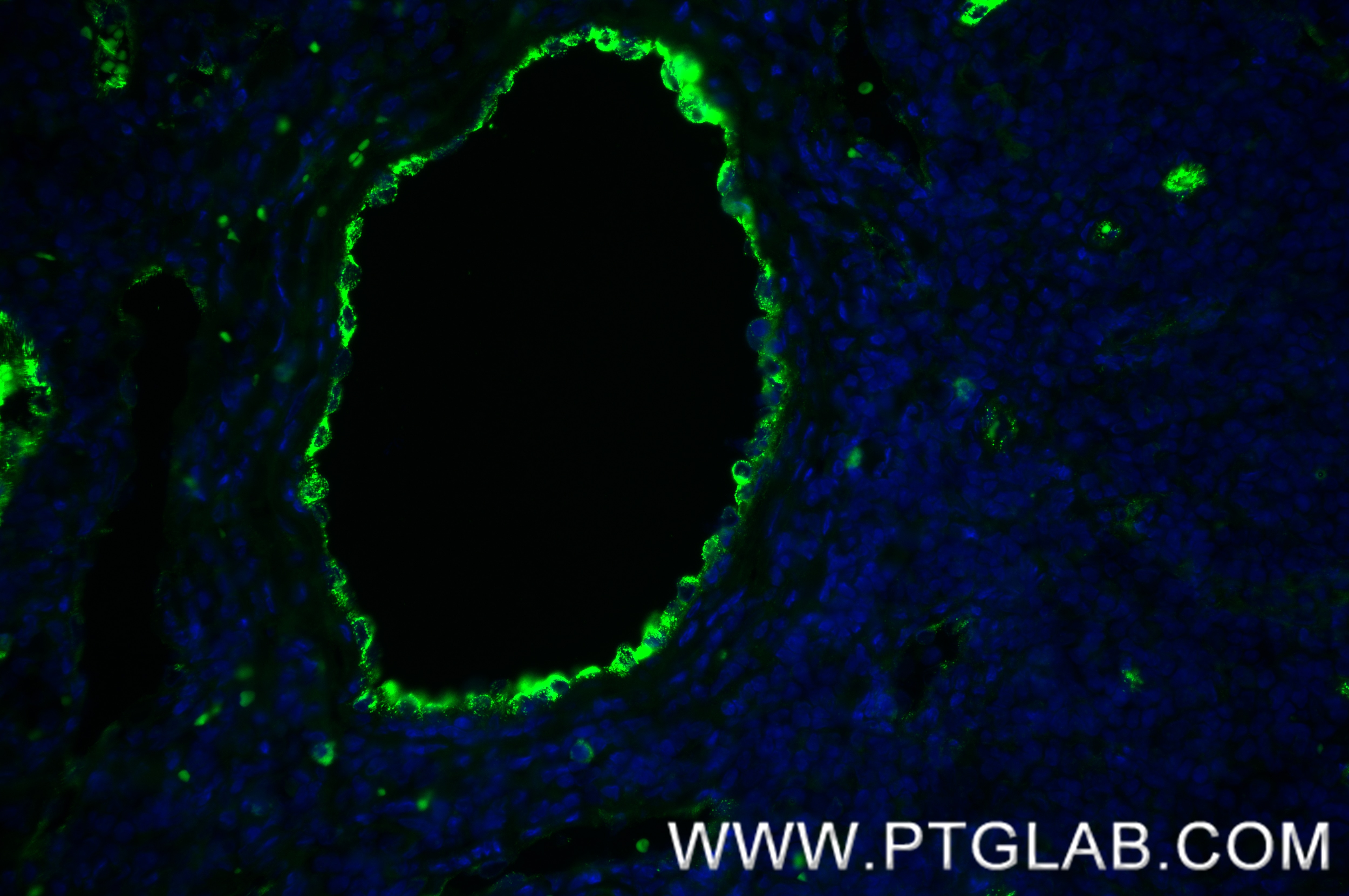 Immunofluorescence (IF) / fluorescent staining of human tonsillitis tissue using VWF Recombinant antibody (83854-2-RR)