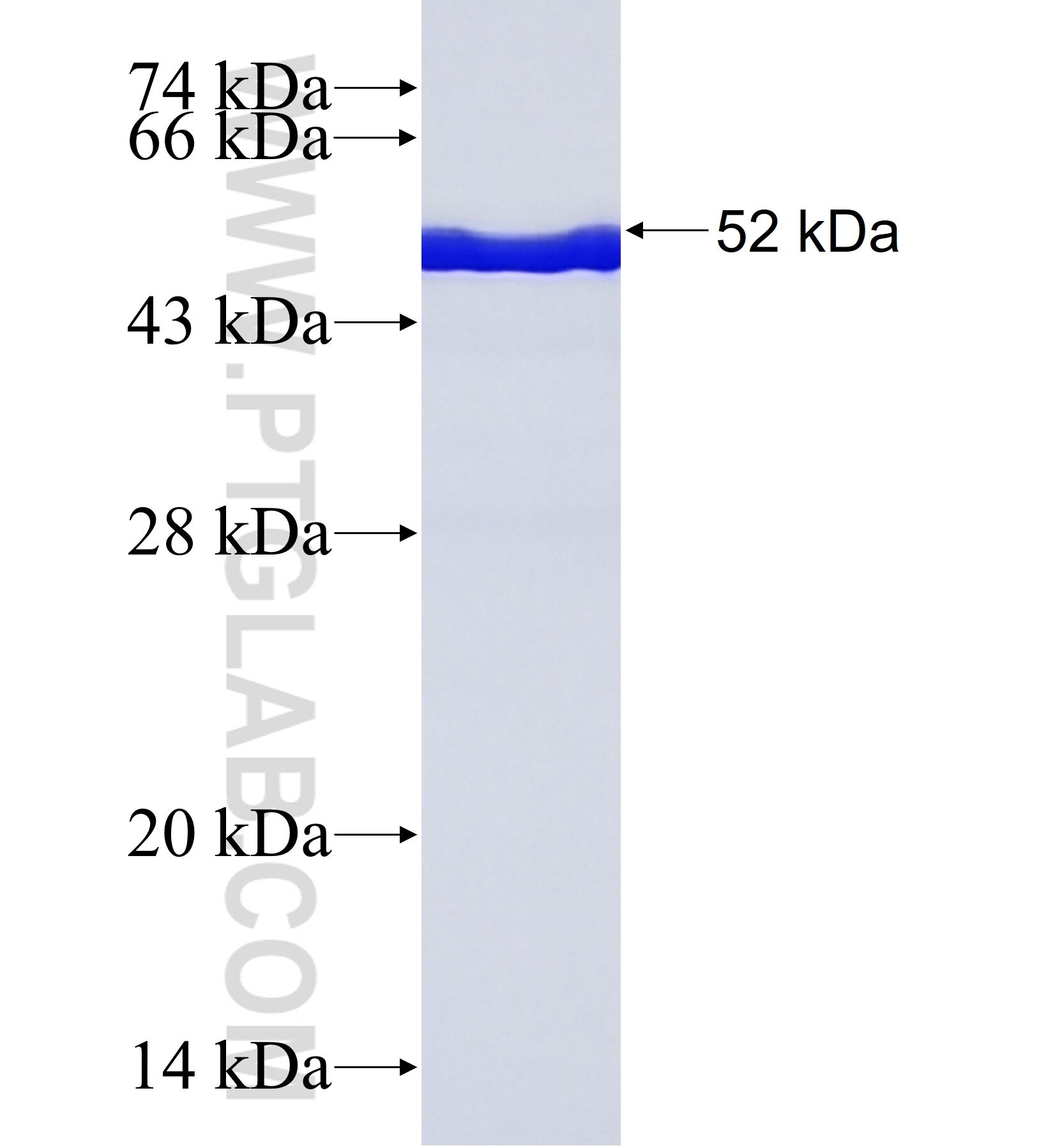 VWF fusion protein Ag41963 SDS-PAGE VWF fusion protein Ag41963 SDS-PAGE