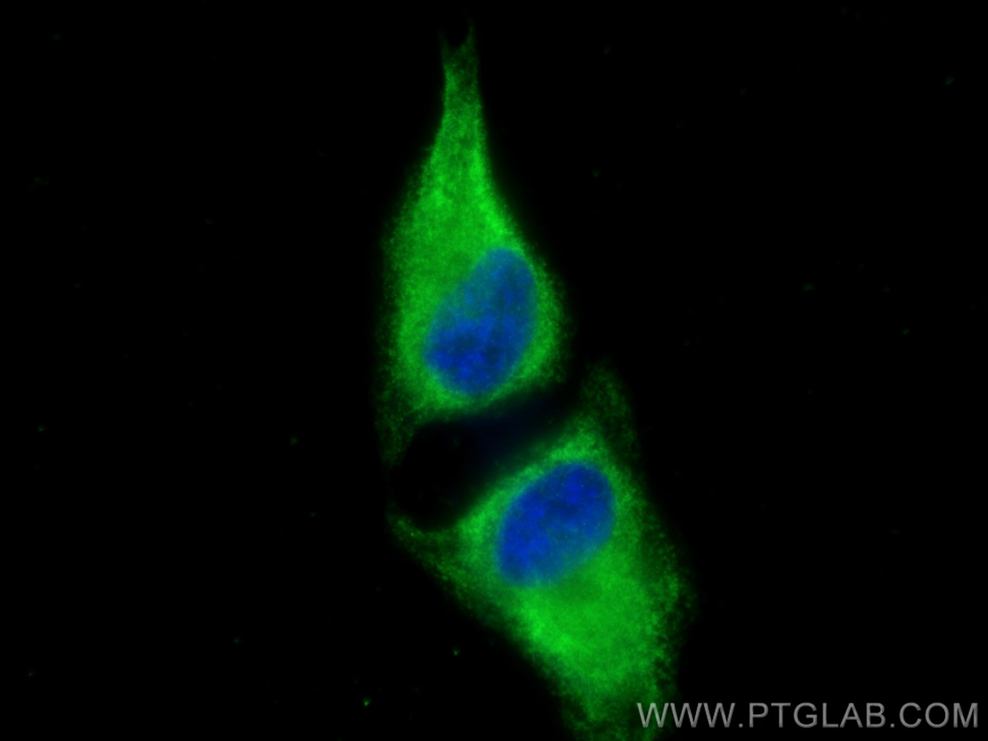 Immunofluorescence (IF) / fluorescent staining of HeLa cells using ValRS Monoclonal antibody (67935-1-Ig)
