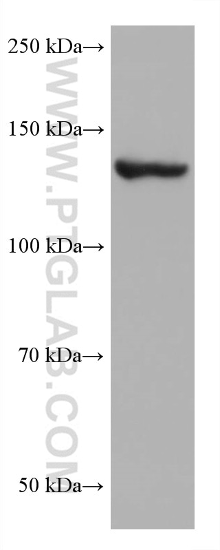 Western Blot (WB) analysis of LNCaP cells using ValRS Monoclonal antibody (67935-1-Ig)