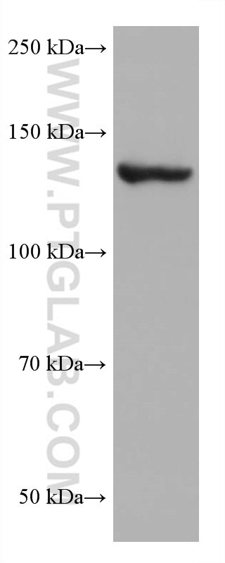 Western Blot (WB) analysis of LNCaP cells using ValRS Monoclonal antibody (67935-1-Ig)